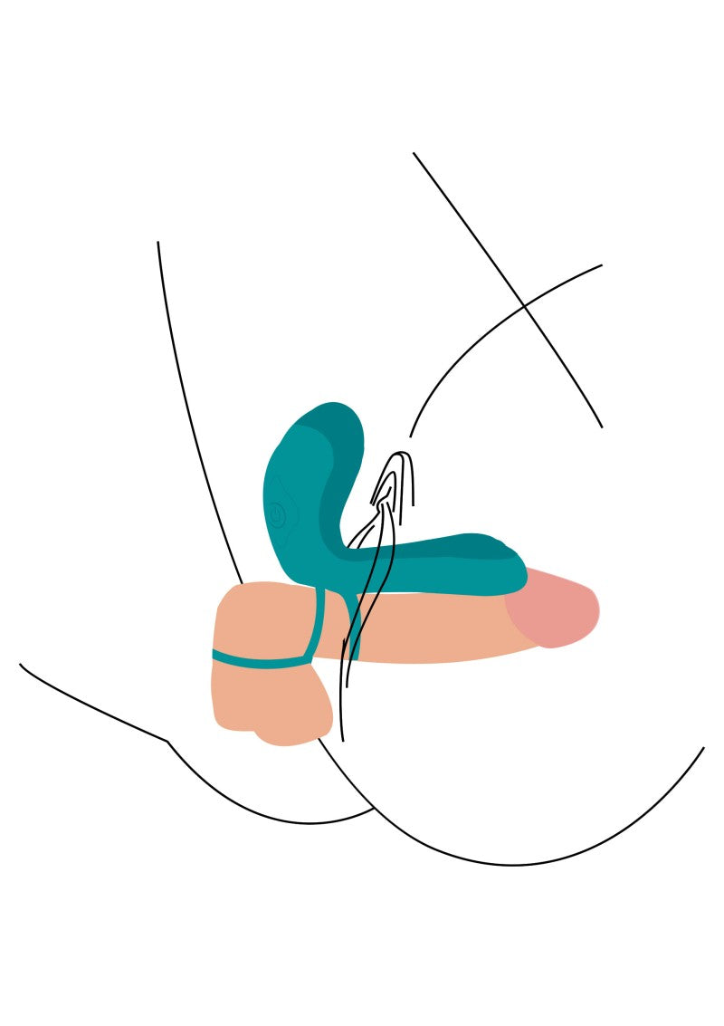 COUPLES VIBRATOR RING