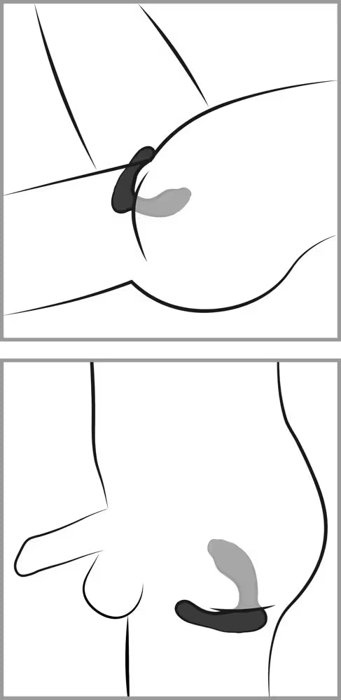 RC G- & P-SPOT VIBRATOR
